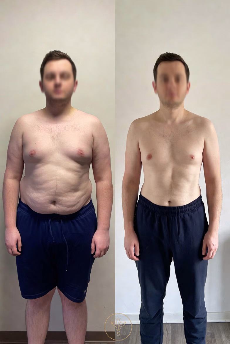 glp 1 weight loss male before and after 1 bodyloom wellness frisco