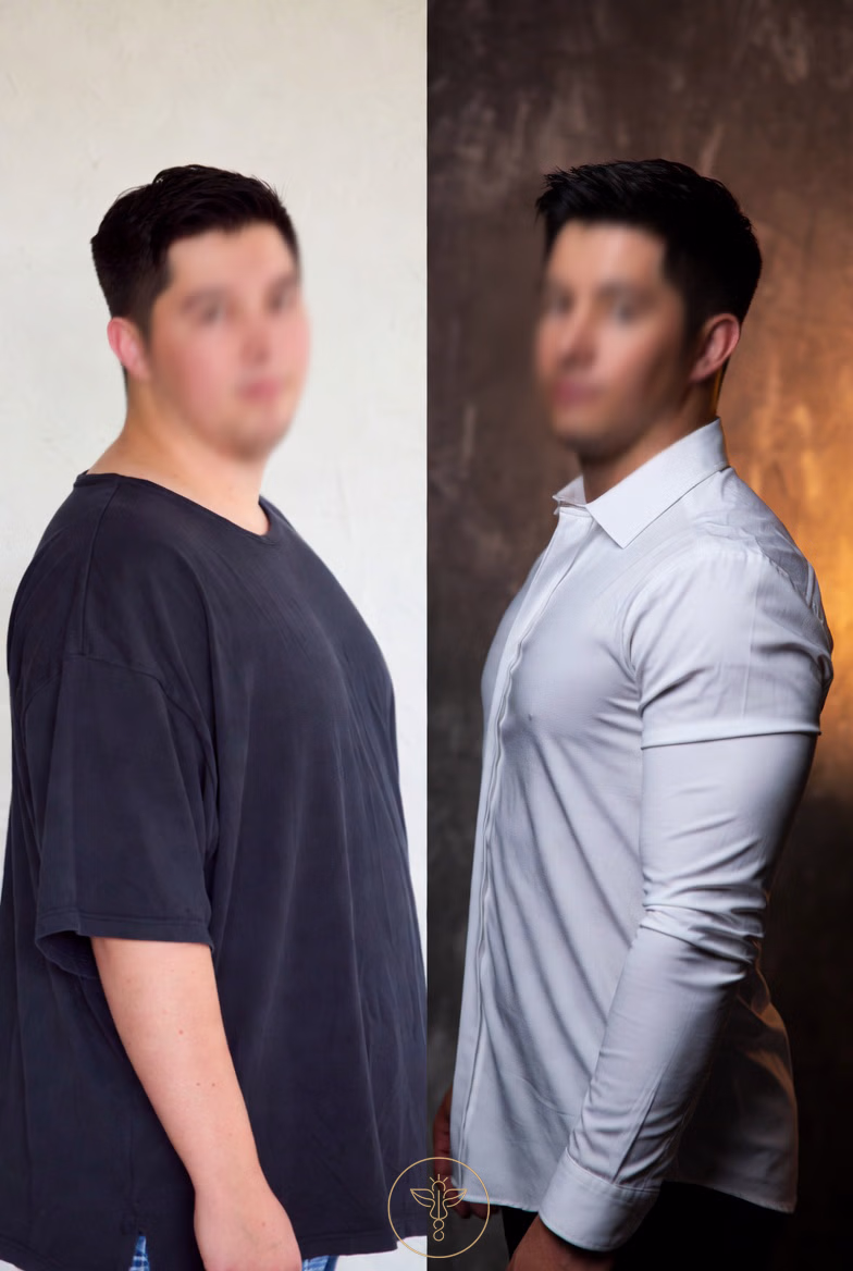 glp-1 weight loss male patient 3 before and after - bodyloom wellness frisco